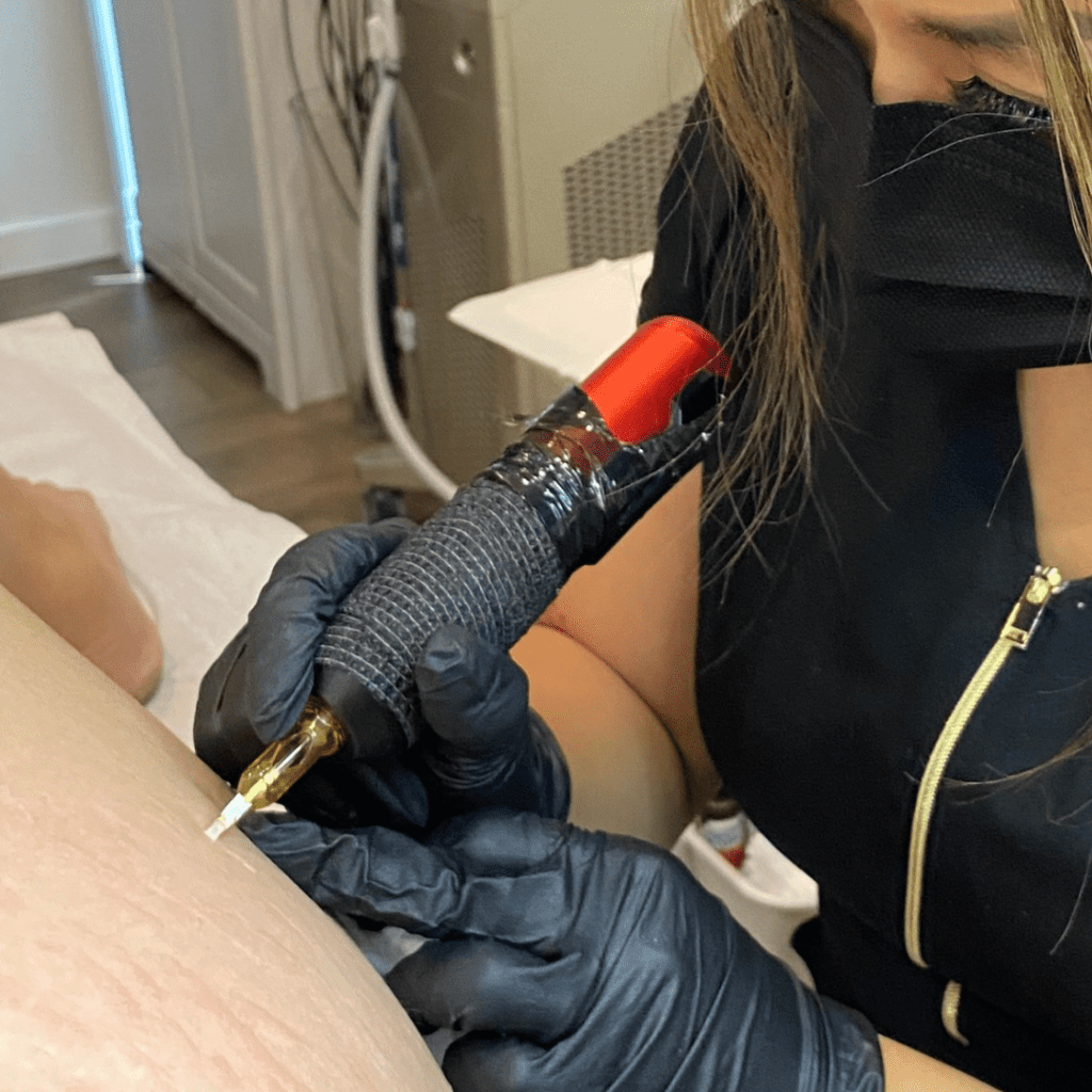 technician at bush whacked laser performing medical camouflage on a clients stretch marks.
